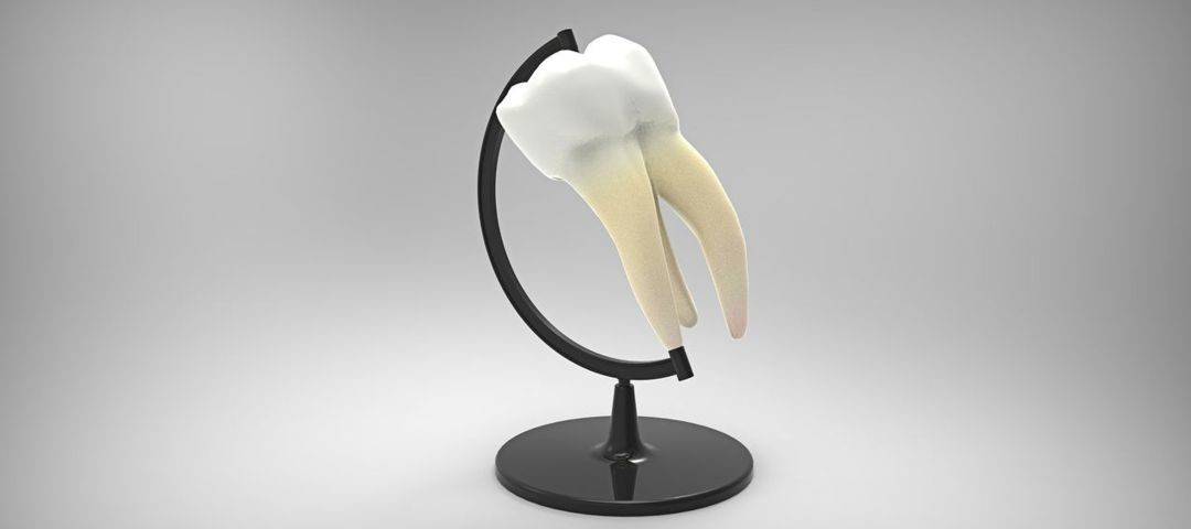 Implanty zębowe – inwestycja na całe życie?
